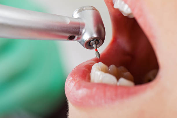Best Cosmetic Emergency Dentistry in Greenville, VA